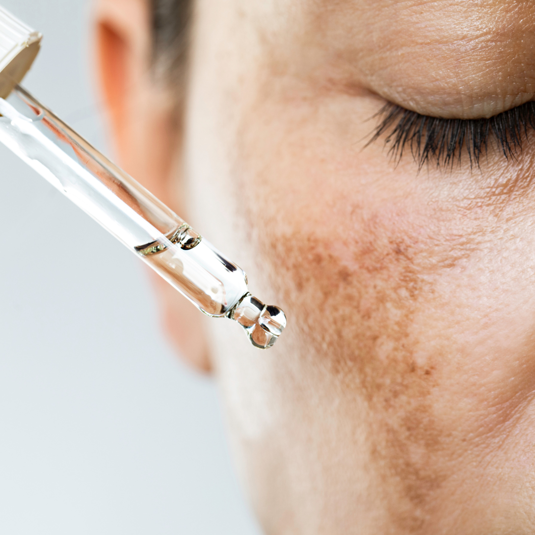 Skin Brightening Treatment