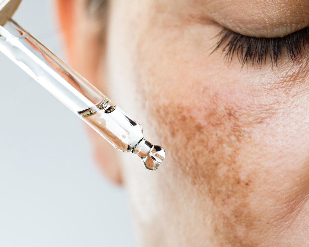 Skin Brightening Treatment