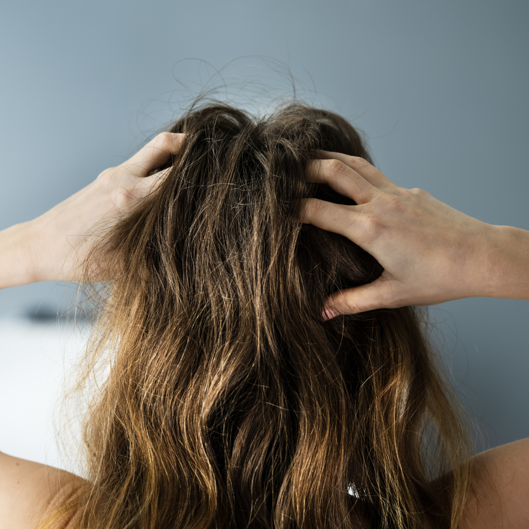 Benefits of Rosemary Essential Oil For Your Hair