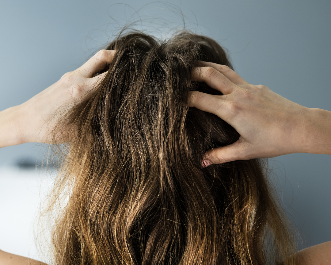 Benefits of Rosemary Essential Oil For Your Hair